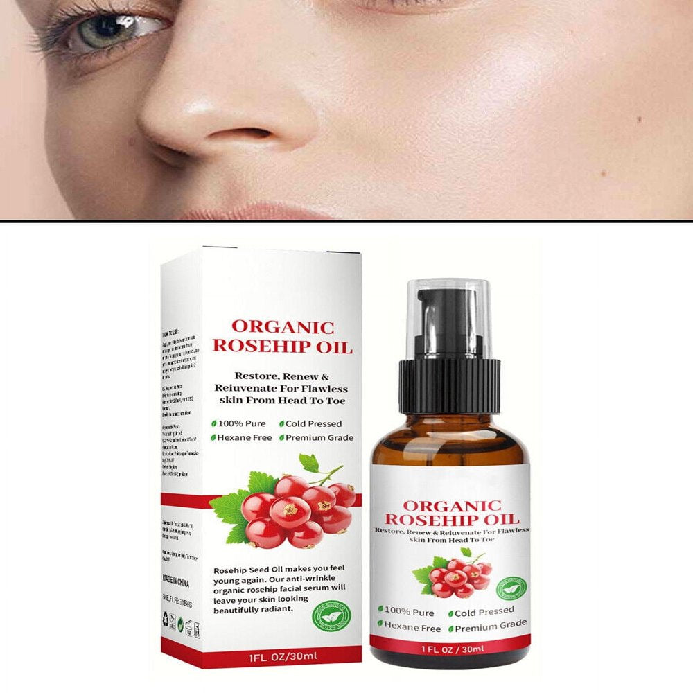 EELHOE Hair Soaps Shampoos Soft Clean Rice Water Soap Hair Care Oil Control Improve Hair Loss Deep Cleansing Scalp Unisex
