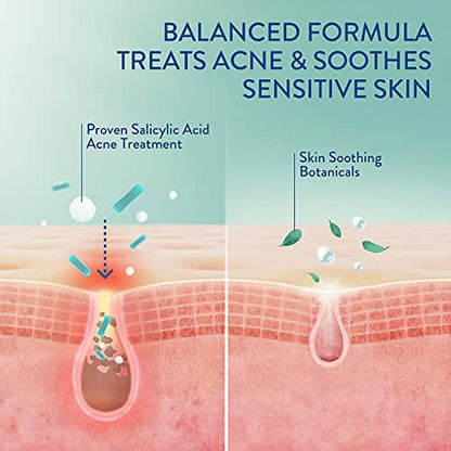 Face Moisturizer, Gentle Clear Mattifying Acne Moisturizer with 0.5% Salicylic Acid, Treats Sensitive Acne Prone Skin, Skin Care Sensitive Skin, 3Oz